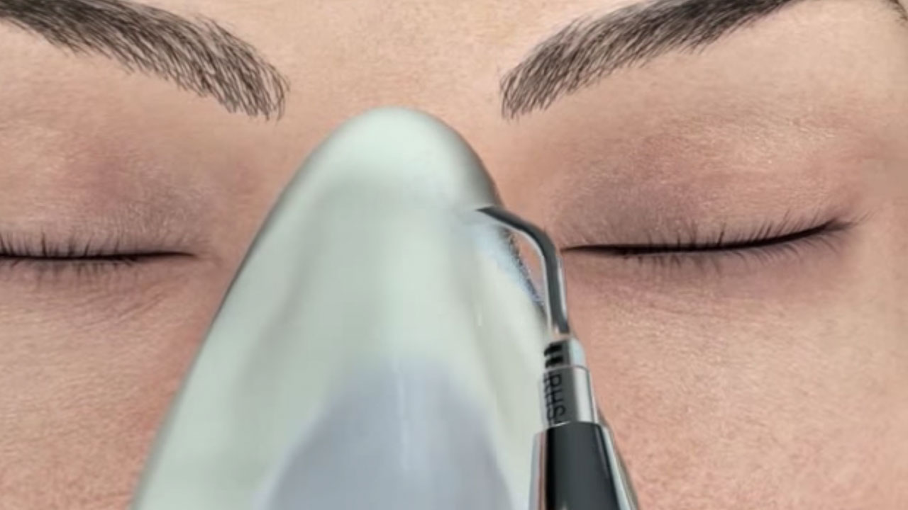 Piezo Rhinoplasty in Portland, Oregon